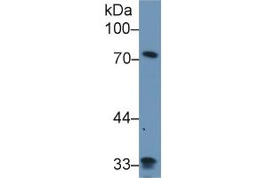 Western Blot; Sample: Human Lung lysate; Primary Ab: 1µg/ml Rabbit Anti-Human ZYX Antibody Second Ab: 0. (ZYX Antikörper  (AA 377-523))