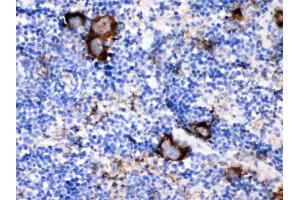 Immunohistochemistry (IHC) image for anti-CD9 (CD9) (AA 110-193) antibody (ABIN4886531)