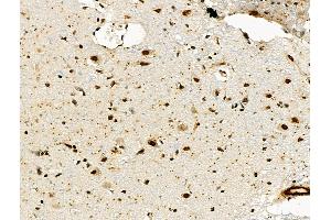 ABIN6260618 and ABIN6276638 at 1/100 staining Rat brain tissue by IHC-P. (CD3D Antikörper  (Internal Region))