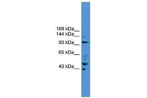 PIBF1 antibody used at 0. (PIBF1 Antikörper  (C-Term))