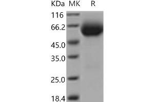 Western Blotting (WB) image for Interleukin 18 Receptor 1 (IL18R1) protein (His tag) (ABIN7196446)