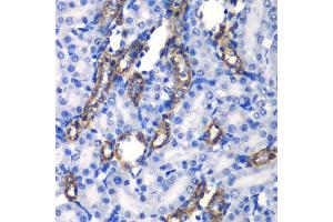 Immunohistochemistry of paraffin-embedded rat kidney using MATK antibody. (MATK Antikörper)