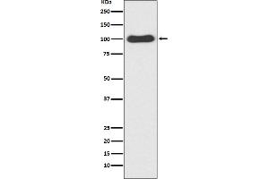 Western blot analysis of CDC5 expression in HeLa cell lysate.