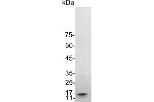 SDS-PAGE (SDS) image for Interleukin 2 (IL2) (Active) protein (His tag) (ABIN7884469)