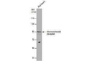 WB Image Glucocorticoid receptor antibody detects Glucocorticoid receptor protein by western blot analysis. (Glucocorticoid Receptor Antikörper  (N-Term))