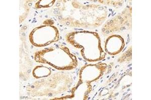 Immunohistochemistry analysis of paraffin-embedded human kidney using,CFA (ABIN7076044) at dilution of 1: 300