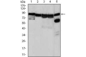 Western Blotting (WB) image for anti-Heat Shock Protein 90kDa alpha (Cytosolic), Class A Member 1 (HSP90AA1) antibody (ABIN1843961) (HSP90AA1 Antikörper)