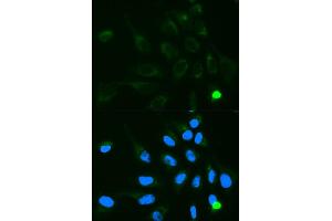 Immunofluorescence analysis of MCF7 cell using UGT1A9 antibody. (UGT1A9 Antikörper)