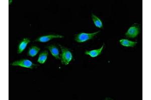 Immunofluorescent analysis of A549 cells using ABIN7150570 at dilution of 1:100 and Alexa Fluor 488-congugated AffiniPure Goat Anti-Rabbit IgG(H+L) (DOK3 Antikörper  (AA 1-146))