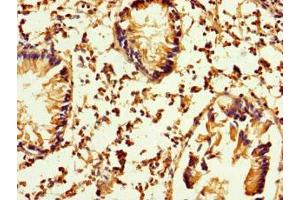 Immunohistochemistry of paraffin-embedded human appendix tissue using ABIN7163366 at dilution of 1:100
