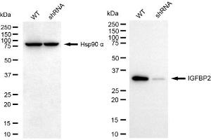 anti-Insulin-Like Growth Factor Binding Protein 2, 36kDa (IGFBP2) antibody