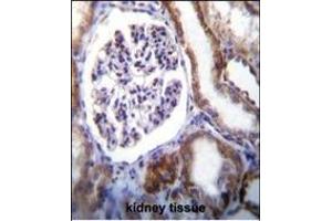 IFT88 Antibody (C-term) (ABIN655090 and ABIN2844723) immunohistochemistry analysis in formalin fixed and paraffin embedded human kidney tissue followed by peroxidase conjugation of the secondary antibody and DAB staining. (IFT88 Antikörper  (C-Term))