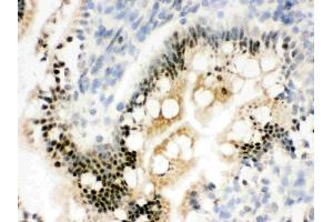 IHC analysis of RbAp48 using anti-RbAp48 antibody . (Retinoblastoma Binding Protein 4 Antikörper  (C-Term))