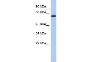 WB Suggested Anti-KLHL7 Antibody Titration: 0. (KLHL7 Antikörper  (Middle Region))