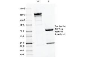 SDS-PAGE Analysis of Purified, BSA-Free PTH Antibody (clone PTH/1175). (PTH Antikörper  (AA 32-115))