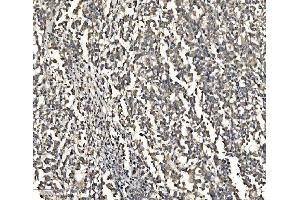 IHC analysis of ATG9A using anti-ATG9A antibody (ABIN7600676).