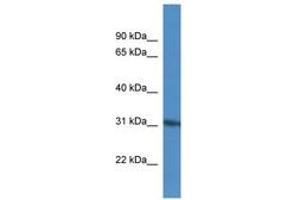 Image no. 1 for anti-Kinesin Family Member 25 (KIF25) (AA 57-106) antibody (ABIN6746071) (KIF25 Antikörper  (AA 57-106))