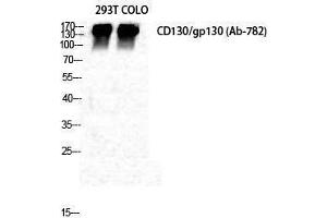 Western Blotting (WB) image for anti-Interleukin 6 Signal Transducer (Gp130, Oncostatin M Receptor) (IL6ST) (Ser552) antibody (ABIN3179917) (CD130/gp130 Antikörper  (Ser552))