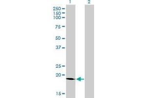 Western Blot analysis of SSR4 expression in transfected 293T cell line by SSR4 monoclonal antibody (M01), clone 2D3. (SSR4 Antikörper  (AA 24-173))