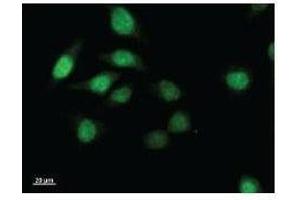Immunostaining analysis in HeLa cells. (TWIST1 Antikörper)