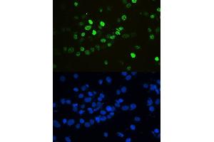IF analysis of HnRNPF using anti-HnRNPF antibody (ABIN4886622). (HNRNPF Antikörper  (N-Term))