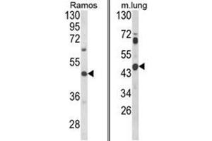 (LEFT) Western blot analysis of CXCR7 Antibody (C-term) in Ramos cell line lysates (35ug/lane). (CXCR7 Antikörper  (C-Term))