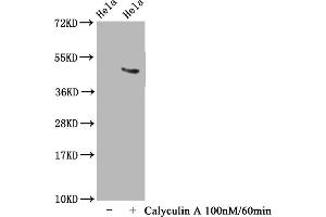 Western Blot Positive WB detected in Hela whole cell lysate(treated with Calyculin A or not) All lanes Phospho-MAPT antibody at 1. (Rekombinanter MAPT Antikörper  (pThr231))
