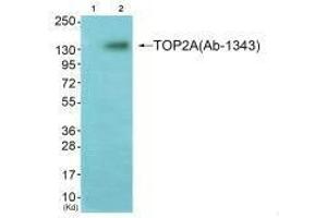 Western blot analysis of extracts from K562 cells (Lane 2), using TOP2A (Ab-1343) antiobdy.