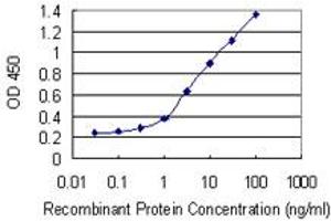 Detection limit for recombinant GST tagged FLT3 is 0. (FLT3 Antikörper  (AA 91-190))