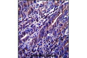 MUC1/E Antibody (C-term) (ABIN657546 and ABIN2846561) immunohistochemistry analysis in forlin fixed and paraffin embedded hun stoch tissue followed by peroxidase conjugation of the secondary antibody and DAB staining. (MUC1 Antikörper  (C-Term))