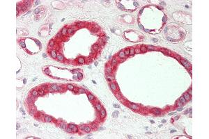 Human Kidney: Formalin-Fixed, Paraffin-Embedded (FFPE). (HMGCS1 Antikörper  (C-Term))