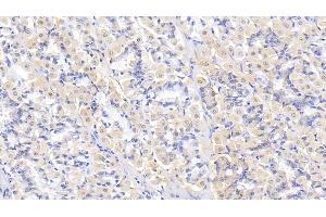 Detection of THBS2 in Human Stomach Tissue using Polyclonal Antibody to Thrombospondin 2 (THBS2)