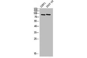 Western Blot analysis of 293T-UV 22RV1 cells using PML Polyclonal Antibody (PML Antikörper  (N-Term))