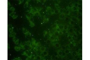 Image no. 3 for anti-RAP2B, Member of RAS Oncogene Family (RAP2B) (AA 1-184) antibody (ABIN598571) (RAP2B Antikörper  (AA 1-184))