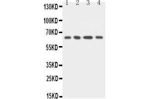 Anti-uPA Receptor antibody, Western blotting Lane 1: MCF-7 Cell Lysate Lane 2: HELA Cell Lysate Lane 3: RAJI Cell Lysate Lane 4: SMMC Cell Lysate (PLAUR Antikörper  (C-Term))