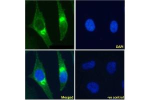 Immunofluoresence staining of fixed HeLa cells with anti-Beta-2 microglobulin antibody BBM.