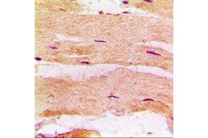 Immunohistochemical analysis of MBNL1 staining in rat heart formalin fixed paraffin embedded tissue section. (MBNL1 Antikörper)