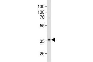 Western blot analysis of lysate from A375 cell line using anti-GAPDH antibody diluted at 1:500. (GAPDH Antikörper  (AA 62-91))