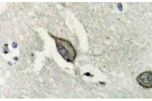 Immunohistochemistry (IHC) analyzes of EphB6 antibody in paraffin-embedded human brain tissue. (EPH Receptor B6 Antikörper)