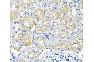 Immunohistochemistry of paraffin-embedded Mouse kidney using HARS2 Polyclonal Antibody at dilution of 1:100 (40x lens).