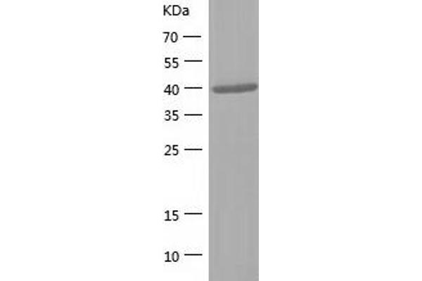 PTGR2 Protein (AA 1-351) (His tag)