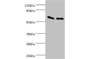 Western blot All lanes: ATP synthase subunit beta, mitochondrial antibody at 9 μg/mL Lane 1: Hela whole cell lysate Lane 2: HepG2 whole cell lysate Secondary Goat polyclonal to rabbit IgG at 1/10000 dilution Predicted band size: 57 kDa Observed band size: 57 kDa