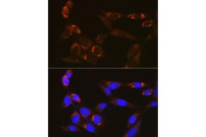 Immunofluorescence analysis of NIH/3T3 cells using PDE4A Rabbit pAb (ABIN7269302) at dilution of 1:100 (40x lens). (PDE4A Antikörper)