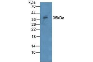Rabbit Capture antibody from the kit in WB with Positive Control: Human Serum. (GDF15 CLIA Kit)