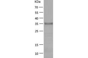 Western Blotting (WB) image for Galactose-1-Phosphate Uridylyltransferase (GALT) (AA 1-379) protein (His tag) (ABIN7123036)