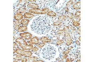 IHC analysis of ATF6 using anti-ATF6 antibody (ABIN7602466). (ATF6 Antikörper  (AA 79-670))