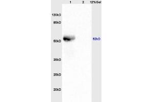 L1 human colon carcinoma lysates, L2 mouse brain lystaes probed (ABIN755647) at 1:200 in 4 °C. (LSP1 Antikörper  (pSer204))