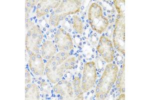 Immunohistochemistry of paraffin-embedded mouse kidney using PSTPIP1 antibody at dilution of 1:100 (x40 lens). (PSTPIP1 Antikörper)