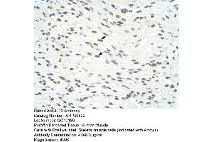 Rabbit Anti-ILF3 Antibody  Paraffin Embedded Tissue: Human Muscle Cellular Data: Skeletal muscle cells Antibody Concentration: 4. (Interleukin enhancer-binding factor 3 (ILF3) (N-Term) Antikörper)