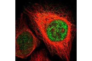 Immunofluorescent staining of U-2 OS with ZIC1 polyclonal antibody  (Green) shows positivity in nucleus but excluded from the nucleoli.
